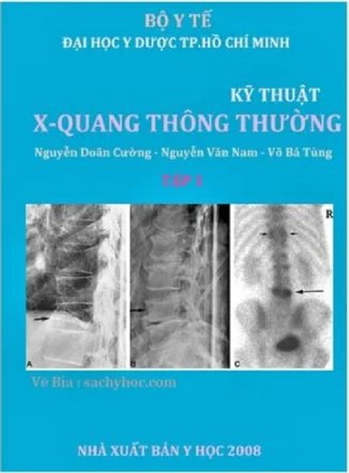Kỹ Thuật X Quang Thông Thường – Tài Liệu Học Tập Ebooks PDF